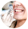 Todos os outros procedimentos citados não podem ser realizados sem uma prévia limpeza dos dentes e uma saúde bucal estabelecida.